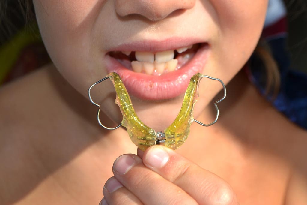 Fabricación de aparatología funcional para cambios estructurales