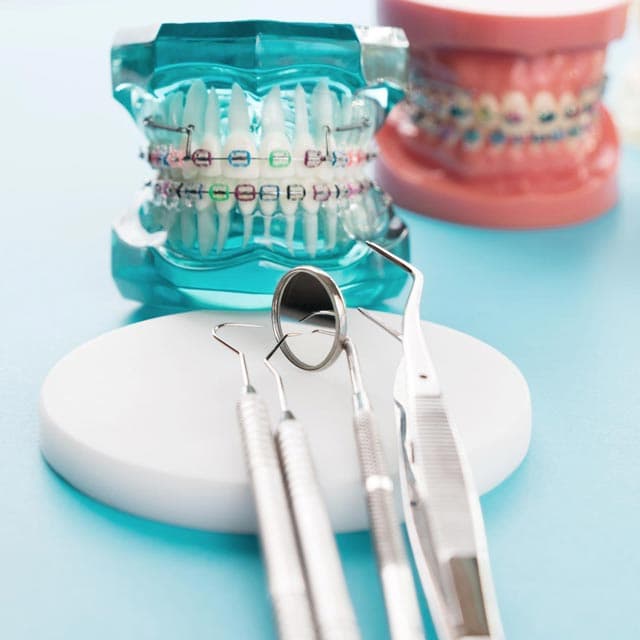 Aparatos fijos en A Coruña para clínicas dentales