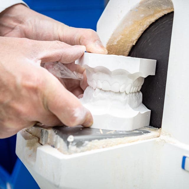 Complementos de ortodoncia para anclaje y diagnóstico