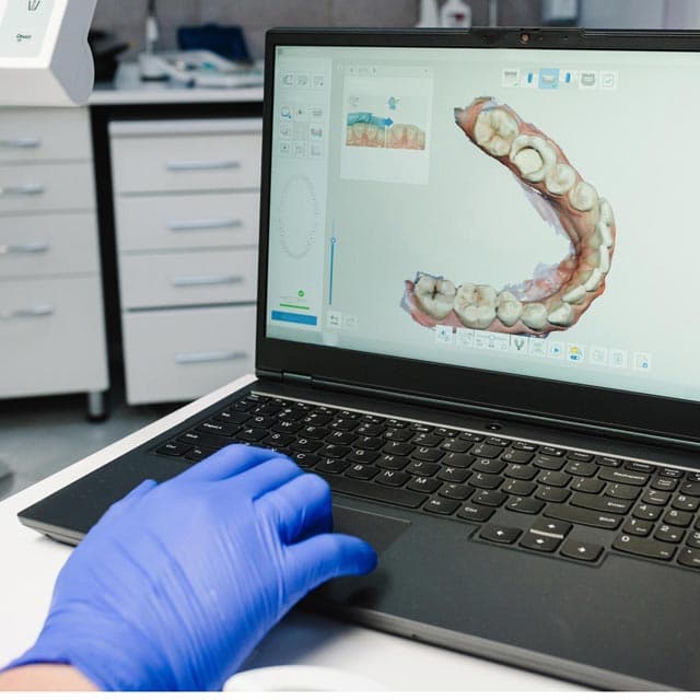Digitalización e impresión 3D para ortodoncia