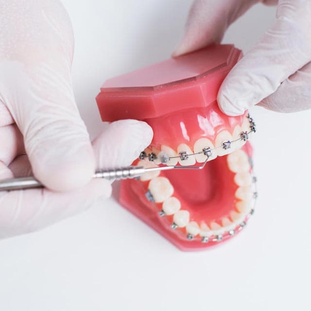 Laboratorio de ortodoncia en A Coruña para profesionales