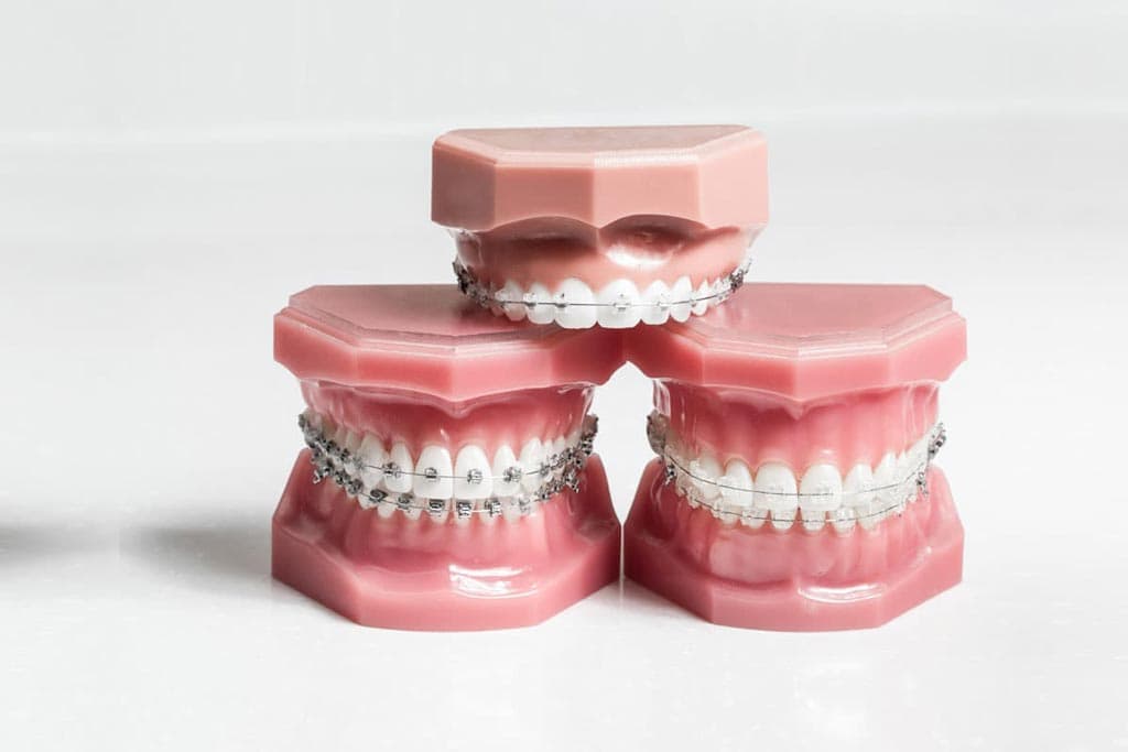 Ortodoncia de última generación en A Coruña