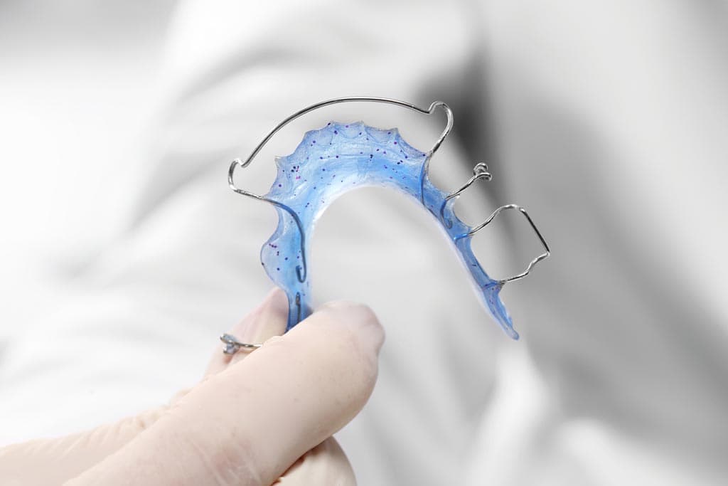 Preguntas frecuentes sobre aparatología funcional