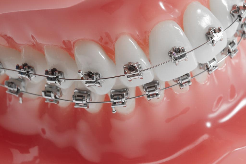 Soluciones de calidad en ortodoncia en A Coruña